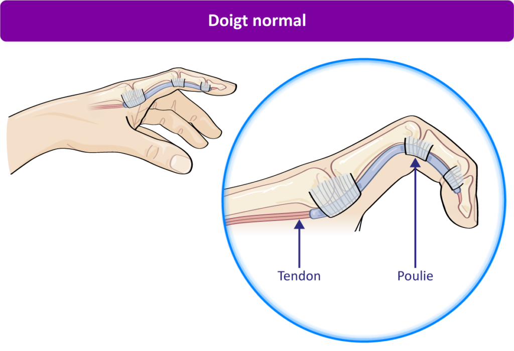 Doigt Normal
