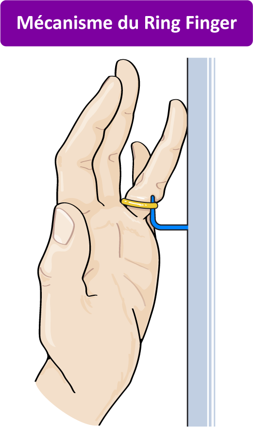 Mécanisme du Ring Finger